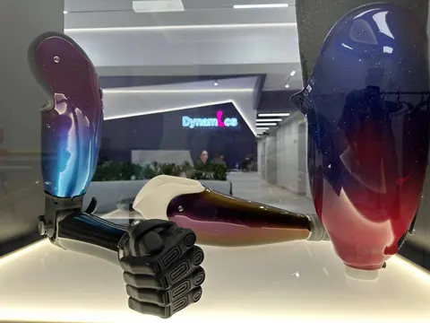 Бесплатные высокотехнологичные протезы ног и рук в 2026 году: как получить по госпрограмме в центре «Динамика»